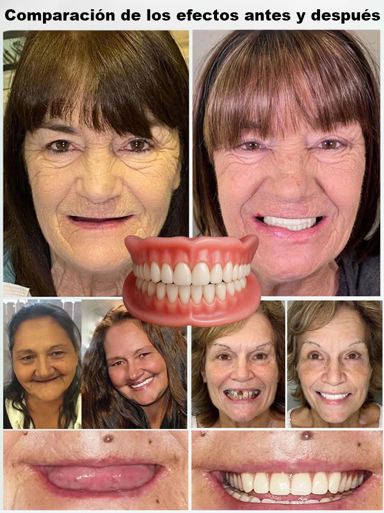 Estuche dental portátil con prótesis: Recupera tu sonrisa-Pago contra entrega